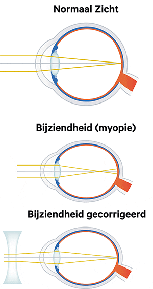 bijziendheid2.gif