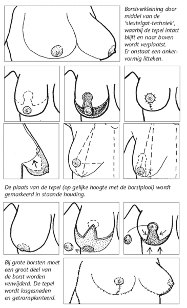 bostverkleining1_002.jpg