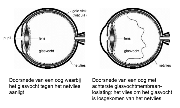 glasvocht.png